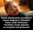 down-sendromu.webp