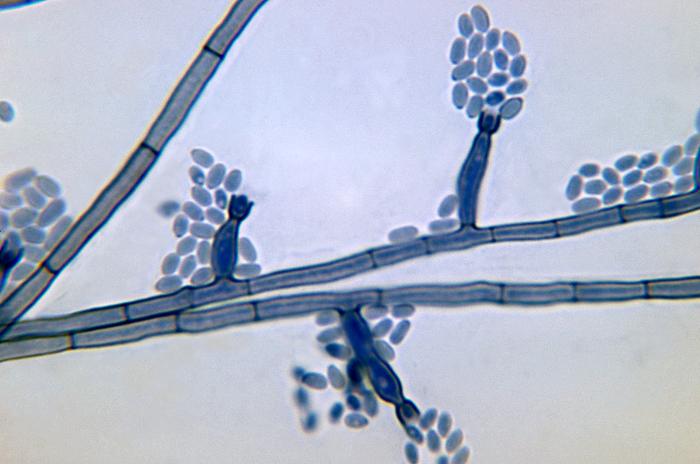 Conidia-laden_conidiophores_of_Phialophora_verrucosa_PHIL_4238_lores.jpg