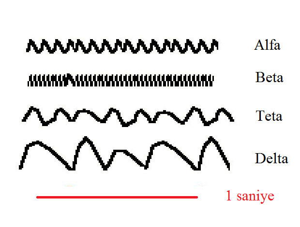 EEG Hakkında Temel Bilgiler