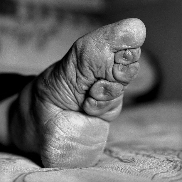 İngiliz fotoğrafçı Jo Farrell Ölmekte olan ayak bağlama geleneğini Çin'in en yaşlı kadınlarıyla yakın zamanda fotoğrafladı.